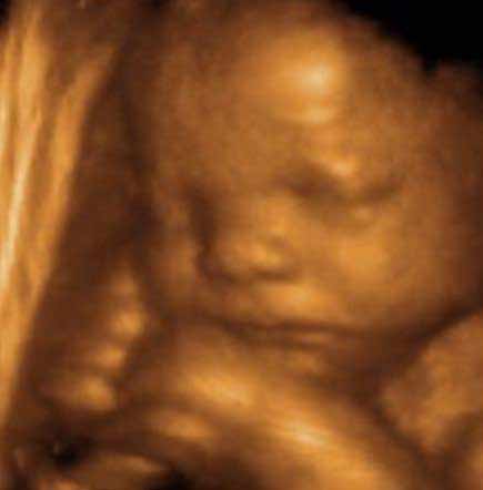 Baby S Close Up 2d 3d 4d 5d Hd Live Ultrasound In Jacksonville Florida